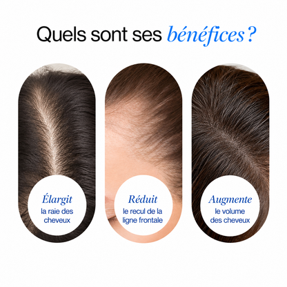 Sérum capillaire avancé en roll-on